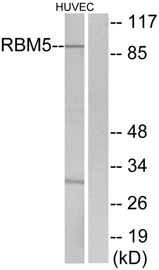 RBM5 / G15 Antibody - Western blot analysis of lysates from HUVEC cells, using RBM5 Antibody. The lane on the right is blocked with the synthesized peptide.