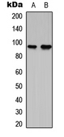 RBM5 / G15 Antibody - Western blot analysis of G15 expression in RT4 (A); NIH3T3 (B) whole cell lysates.