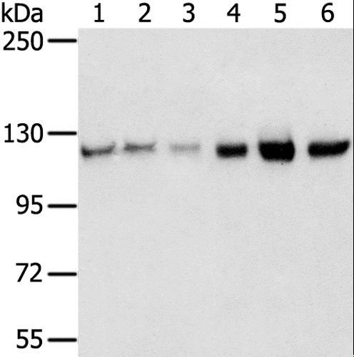 RBM5 / G15 Antibody - Western blot analysis of 823, A549, K562, 293T, hepg2 and HUVEC cell, using RBM5 Polyclonal Antibody at dilution of 1:450.