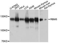 RBM5 / G15 Antibody - Western blot analysis of extracts of various cell lines, using RBM5 antibody at 1:1000 dilution. The secondary antibody used was an HRP Goat Anti-Rabbit IgG (H+L) at 1:10000 dilution. Lysates were loaded 25ug per lane and 3% nonfat dry milk in TBST was used for blocking. An ECL Kit was used for detection and the exposure time was 30s.