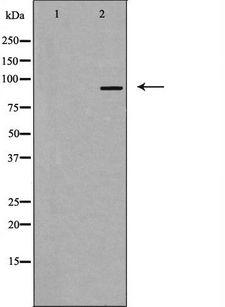 RBM5 / G15 Antibody - Western blot analysis of extracts of HuvEc cells using RBM5 antibody. The lane on the left is treated with the antigen-specific peptide.
