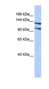 RBM5 / G15 Antibody - RBM5 antibody western blot of HepG2 cell lysate.  This image was taken for the unconjugated form of this product. Other forms have not been tested.