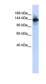 RBM6 / 3G2 Antibody - RBM6 antibody Western blot of HepG2 cell lysate. This image was taken for the unconjugated form of this product. Other forms have not been tested.