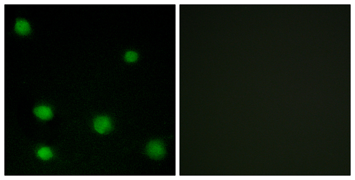 RBM6 / 3G2 Antibody - Immunofluorescence analysis of COS7 cells, using RBM6 Antibody. The picture on the right is blocked with the synthesized peptide.