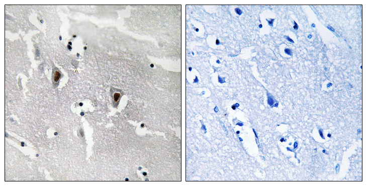 RBM6 / 3G2 Antibody - Immunohistochemistry analysis of paraffin-embedded human brain tissue, using RBM6 Antibody. The picture on the right is blocked with the synthesized peptide.