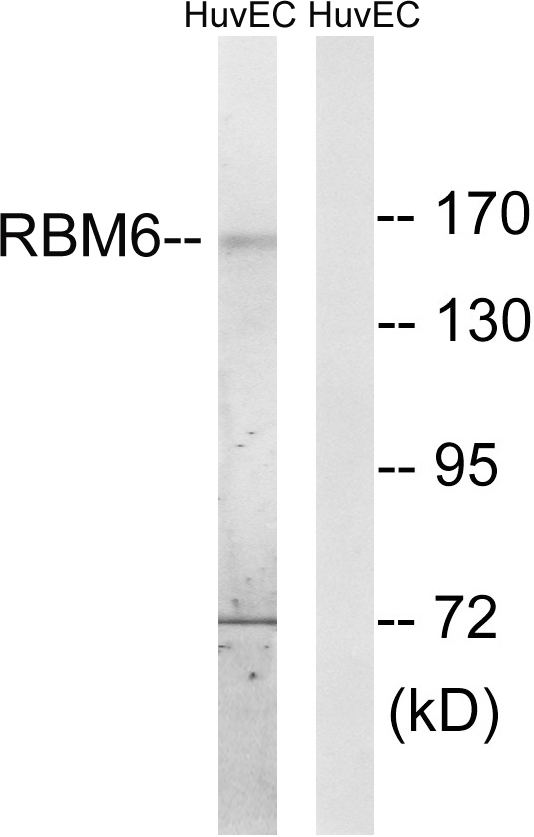 RBM6 / 3G2 Antibody - Western blot analysis of lysates from HUVEC cells, using RBM6 Antibody. The lane on the right is blocked with the synthesized peptide.