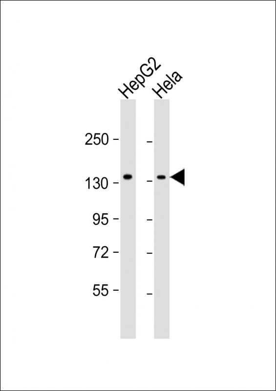 RBM6 / 3G2 Antibody - All lanes: Anti-RBM6 Antibody at 1:1000 dilution. Lane 1: HepG2 whole cell lysate. Lane 2: HeLa whole cell lysate Lysates/proteins at 20 ug per lane. Secondary Goat Anti-mouse IgG, (H+L), Peroxidase conjugated at 1:10000 dilution. Predicted band size: 129 kDa. Blocking/Dilution buffer: 5% NFDM/TBST.