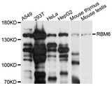 RBM6 / 3G2 Antibody - Western blot analysis of extracts of various cell lines.