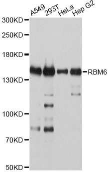 RBM6 / 3G2 Antibody - Western blot analysis of extracts of various cell lines, using RBM6 antibody at 1:2000 dilution. The secondary antibody used was an HRP Goat Anti-Rabbit IgG (H+L) at 1:10000 dilution. Lysates were loaded 25ug per lane and 3% nonfat dry milk in TBST was used for blocking. An ECL Kit was used for detection and the exposure time was 5s.