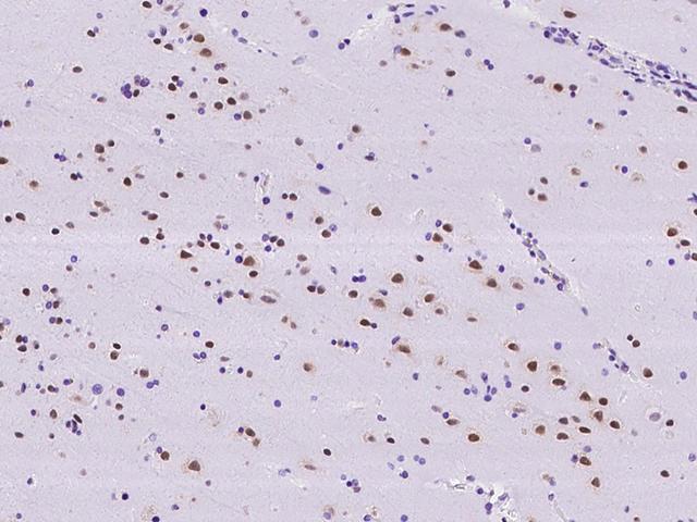 RBM6 / 3G2 Antibody - Immunochemical staining of human RBM6 in human brain with rabbit polyclonal antibody at 1:500 dilution, formalin-fixed paraffin embedded sections.