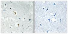 RBM6 / 3G2 Antibody - Peptide - + Immunohistochemistry analysis of paraffin-embedded human brain tissue using RBM6 antibody.