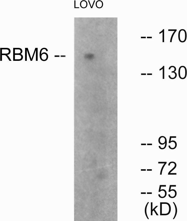 RBM6 / 3G2 Antibody - Western blot analysis of extracts from LOVO cells, using RBM6 antibody.