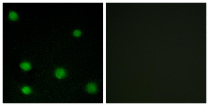 RBM6 / 3G2 Antibody - Peptide - + Immunofluorescence analysis of COS-7 cells, using RBM6 antibody.