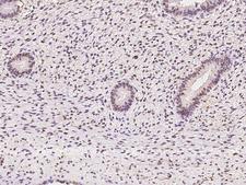 RBM7 Antibody - Immunochemical staining of human RBM7 in human corpus uteri with rabbit polyclonal antibody at 1:100 dilution, formalin-fixed paraffin embedded sections.