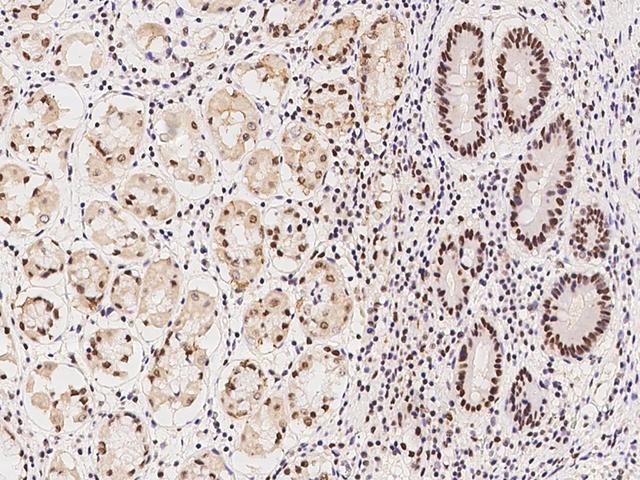 RBM7 Antibody - Immunochemical staining of human RBM7 in human stomach with rabbit polyclonal antibody at 1:100 dilution, formalin-fixed paraffin embedded sections.