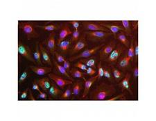 RBM8A / Y14 Antibody - Immunocytochemistry/ Immunofluorescence-Y14 antibody [4C4] stained HeLa cells