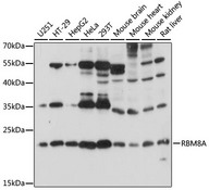 RBM8A / Y14 Antibody - Western blot analysis of extracts of various cell lines, using RBM8A antibody at 1:1000 dilution. The secondary antibody used was an HRP Goat Anti-Rabbit IgG (H+L) at 1:10000 dilution. Lysates were loaded 25ug per lane and 3% nonfat dry milk in TBST was used for blocking. An ECL Kit was used for detection and the exposure time was 10s.