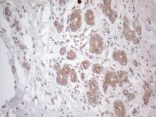 RBMS1 Antibody - Immunohistochemical staining of paraffin-embedded Human breast tissue within the normal limits using anti-RBMS1 mouse monoclonal antibody. (Heat-induced epitope retrieval by 1mM EDTA in 10mM Tris buffer. (pH8.5) at 120°C for 3 min. (1:150)
