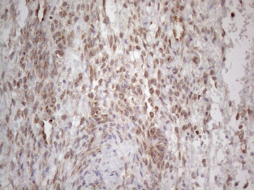 RBMS1 Antibody - Immunohistochemical staining of paraffin-embedded Human Ovary tissue within the normal limits using anti-RBMS1 mouse monoclonal antibody. (Heat-induced epitope retrieval by 1mM EDTA in 10mM Tris buffer. (pH8.5) at 120°C for 3 min. (1:150)