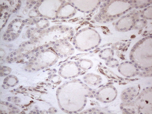 RBMS1 Antibody - Immunohistochemical staining of paraffin-embedded Human thyroid tissue within the normal limits using anti-RBMS1 mouse monoclonal antibody. (Heat-induced epitope retrieval by 1mM EDTA in 10mM Tris buffer. (pH8.5) at 120°C for 3 min. (1:150)