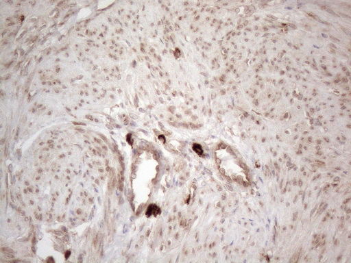 RBMS1 Antibody - Immunohistochemical staining of paraffin-embedded Human endometrium tissue within the normal limits using anti-RBMS1 mouse monoclonal antibody. (Heat-induced epitope retrieval by 1mM EDTA in 10mM Tris buffer. (pH8.5) at 120°C for 3 min. (1:150)