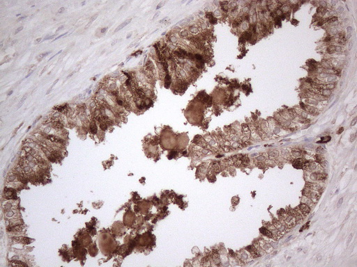 RBMS1 Antibody - Immunohistochemical staining of paraffin-embedded Human prostate tissue within the normal limits using anti-RBMS1 mouse monoclonal antibody. (Heat-induced epitope retrieval by 1mM EDTA in 10mM Tris buffer. (pH8.5) at 120°C for 3 min. (1:150)
