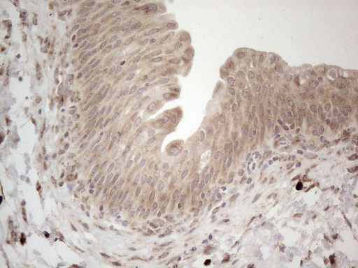 RBMS1 Antibody - Immunohistochemical staining of paraffin-embedded Human bladder tissue within the normal limits using anti-RBMS1 mouse monoclonal antibody. (Heat-induced epitope retrieval by 1mM EDTA in 10mM Tris buffer. (pH8.5) at 120°C for 3 min. (1:150)