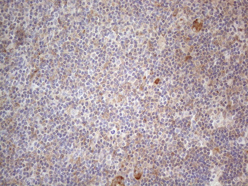 RBMS1 Antibody - Immunohistochemical staining of paraffin-embedded Human tonsil within the normal limits using anti-RBMS1 mouse monoclonal antibody. (Heat-induced epitope retrieval by 1mM EDTA in 10mM Tris buffer. (pH8.5) at 120°C for 3 min. (1:150)