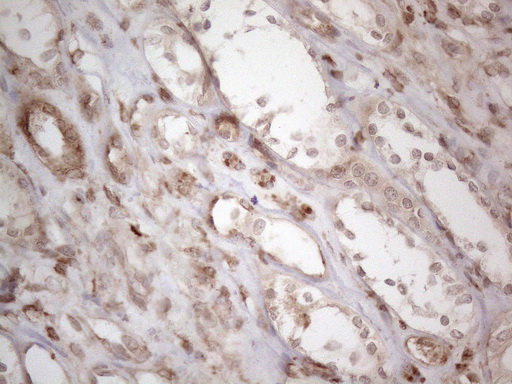 RBMS1 Antibody - Immunohistochemical staining of paraffin-embedded Human Kidney tissue within the normal limits using anti-RBMS1 mouse monoclonal antibody. (Heat-induced epitope retrieval by 1mM EDTA in 10mM Tris buffer. (pH8.5) at 120°C for 3 min. (1:150)