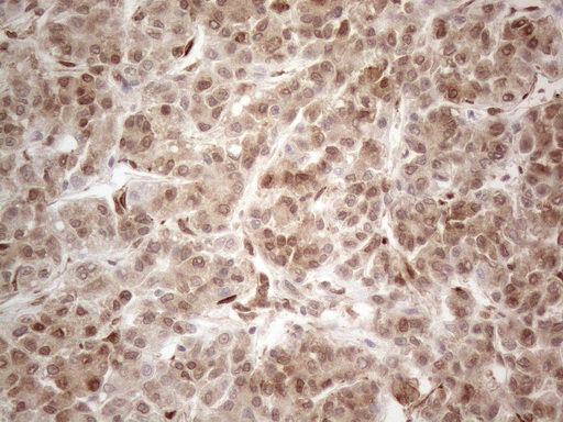 RBMS1 Antibody - Immunohistochemical staining of paraffin-embedded Human liver tissue within the normal limits using anti-RBMS1 mouse monoclonal antibody. (Heat-induced epitope retrieval by 1mM EDTA in 10mM Tris buffer. (pH8.5) at 120°C for 3 min. (1:150)