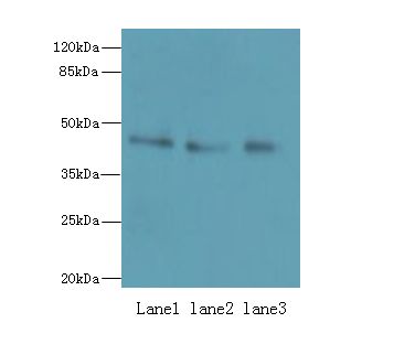 RBMS2 / SCR3 Antibody - Western blot. All lanes: RBMS2 antibody at 0.5 ug/ml. Lane 1: A431 whole cell lysate. Lane 2: Jurkat whole cell lysate. Lane 3: MCF7 whole cell lysate. Secondary antibody: Goat polyclonal to Rabbit IgG at 1:10000 dilution. Predicted band size: 44 kDa. Observed band size: 44 kDa.