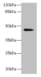 RBMS2 / SCR3 Antibody - Western blot All lanes: RBMS2 antibody at 0.5µg/ml Lane 1: A431 whole cell lysate Lane 2: Jurkat whole cell lysate Lane 3: MCF-7 whole cell lysate Secondary Goat polyclonal to rabbit IgG at 1/10000 dilution Predicted band size: 44 kDa Observed band size: 44 kDa