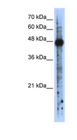 RBMS2 / SCR3 Antibody - RBMS2 antibody Western blot of Transfected 293T cell lysate. This image was taken for the unconjugated form of this product. Other forms have not been tested.