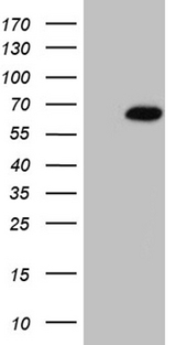 RBMS3 Antibody - HEK293T cells were transfected with the pCMV6-ENTRY control. (Left lane) or pCMV6-ENTRY RBMS3. (Right lane) cDNA for 48 hrs and lysed. Equivalent amounts of cell lysates. (5 ug per lane) were separated by SDS-PAGE and immunoblotted with anti-RBMS3. (1:2000)