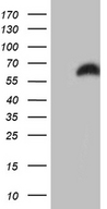 RBMS3 Antibody - HEK293T cells were transfected with the pCMV6-ENTRY control. (Left lane) or pCMV6-ENTRY RBMS3. (Right lane) cDNA for 48 hrs and lysed. Equivalent amounts of cell lysates. (5 ug per lane) were separated by SDS-PAGE and immunoblotted with anti-RBMS3. (1:2000)