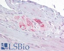 RBMS3 Antibody - Anti-RBMS3 antibody IHC of human small intestine, myenteric plexus. Immunohistochemistry of formalin-fixed, paraffin-embedded tissue after heat-induced antigen retrieval. Antibody concentration 10 ug/ml.  This image was taken for the unconjugated form of this product. Other forms have not been tested.