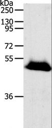 RBMS3 Antibody - Western blot analysis of Human liver cancer tissue, using RBMS3 Polyclonal Antibody at dilution of 1:1000.
