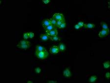RBMS3 Antibody - Immunofluorescence staining of HepG2 cells at a dilution of 1:300, counter-stained with DAPI. The cells were fixed in 4% formaldehyde, permeabilized using 0.2% Triton X-100 and blocked in 10% normal Goat Serum. The cells were then incubated with the antibody overnight at 4 °C.The secondary antibody was Alexa Fluor 488-congugated AffiniPure Goat Anti-Rabbit IgG (H+L) .