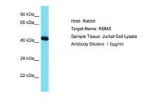 RBMX Antibody -  This image was taken for the unconjugated form of this product. Other forms have not been tested.