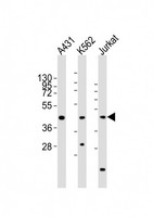 RBMX Antibody - All lanes : Anti-RBMX Antibody at 1:2000 dilution Lane 1: A431 whole cell lysates Lane 2: K562 whole cell lysates Lane 3: Jurkat whole cell lysates Lysates/proteins at 20 ug per lane. Secondary Goat Anti-Rabbit IgG, (H+L), Peroxidase conjugated at 1/10000 dilution Predicted band size : 42 kDa Blocking/Dilution buffer: 5% NFDM/TBST.