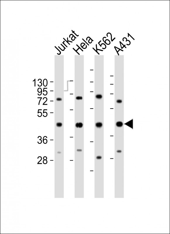 RBMX Antibody - All lanes : Anti-RBMX Antibody at 1:2000 dilution Lane 1: Jurkat whole cell lysates Lane 2: HeLa whole cell lysates Lane 3: K562 whole cell lysates Lane 4: A431 whole cell lysates Lysates/proteins at 20 ug per lane. Secondary Goat Anti-Rabbit IgG, (H+L), Peroxidase conjugated at 1/10000 dilution Predicted band size : 42 kDa Blocking/Dilution buffer: 5% NFDM/TBST.