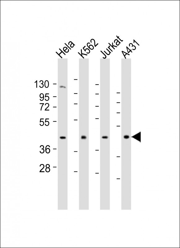 RBMX Antibody - All lanes: Anti-RBMX Antibody (Center) at 1:1000-1:2000 dilution. Lane 1: HeLa whole cell lysates. Lane 2: K562 whole cell lysates. Lane 3: Jurkat whole cell lysates. Lane 4: A431 whole cell lysates Lysates/proteins at 20 ug per lane. Secondary Goat Anti-Rabbit IgG, (H+L), Peroxidase conjugated at 1:10000 dilution. Predicted band size: 42 kDa. Blocking/Dilution buffer: 5% NFDM/TBST.
