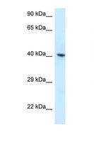 RBMX Antibody - RBMX antibody Western blot of 3 Cell lysate. Antibody concentration 1 ug/ml.  This image was taken for the unconjugated form of this product. Other forms have not been tested.