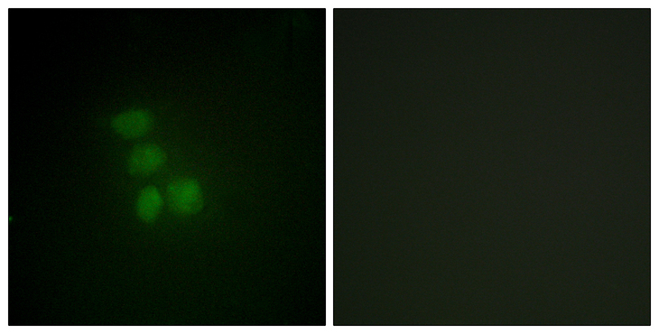 RBMX Antibody - Immunofluorescence analysis of HepG2 cells, using hnRNP G Antibody. The picture on the right is blocked with the synthesized peptide.