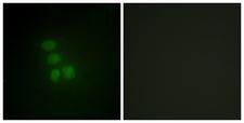 RBMX Antibody - Immunofluorescence analysis of HepG2 cells, using hnRNP G Antibody. The picture on the right is blocked with the synthesized peptide.