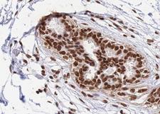 RBMX Antibody - 1:100 staining human breast tissue by IHC-P. The tissue was formaldehyde fixed and a heat mediated antigen retrieval step in citrate buffer was performed. The tissue was then blocked and incubated with the antibody for 1.5 hours at 22°C. An HRP conjugated goat anti-rabbit antibody was used as the secondary.
