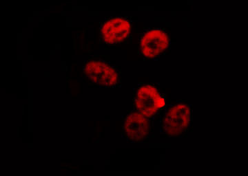 RBMX Antibody - Staining HeLa cells by IF/ICC. The samples were fixed with PFA and permeabilized in 0.1% Triton X-100, then blocked in 10% serum for 45 min at 25°C. The primary antibody was diluted at 1:200 and incubated with the sample for 1 hour at 37°C. An Alexa Fluor 594 conjugated goat anti-rabbit IgG (H+L) Ab, diluted at 1/600, was used as the secondary antibody.