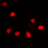 RBMX Antibody - Immunofluorescent analysis of hnRNP G staining in Jurkat cells. Formalin-fixed cells were permeabilized with 0.1% Triton X-100 in TBS for 5-10 minutes and blocked with 3% BSA-PBS for 30 minutes at room temperature. Cells were probed with the primary antibody in 3% BSA-PBS and incubated overnight at 4 deg C in a humidified chamber. Cells were washed with PBST and incubated with a DyLight 594-conjugated secondary antibody (red) in PBS at room temperature in the dark. DAPI was used to stain the cell nuclei (blue).