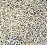 RBMX2 Antibody - RBMX2 Antibody immunohistochemistry of formalin-fixed and paraffin-embedded human spleen tissue followed by peroxidase-conjugated secondary antibody and DAB staining.