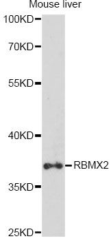 RBMX2 Antibody - Western blot analysis of extracts of mouse liver, using RBMX2 antibody at 1:1000 dilution. The secondary antibody used was an HRP Goat Anti-Rabbit IgG (H+L) at 1:10000 dilution. Lysates were loaded 25ug per lane and 3% nonfat dry milk in TBST was used for blocking. An ECL Kit was used for detection and the exposure time was 90s.